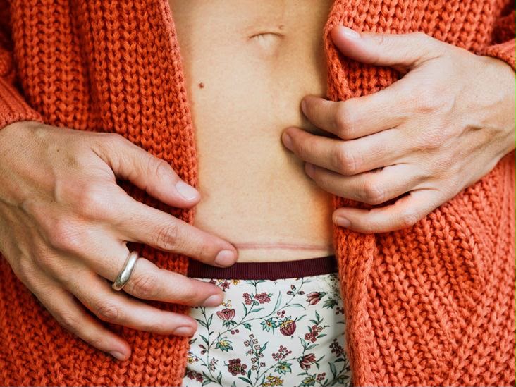 Post-Surgical Rehabilitation